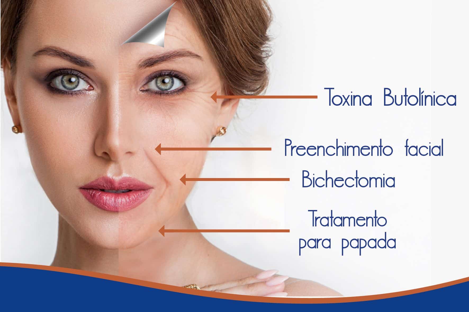 tipos de tratamento