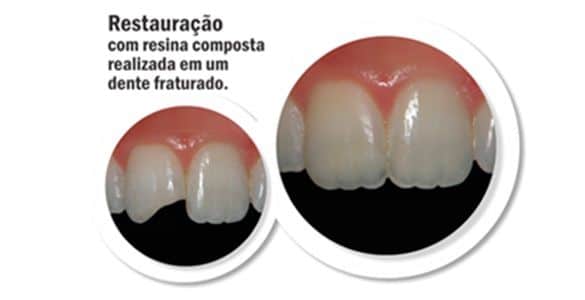 restauração antes e depois