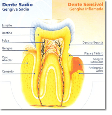 anatomia de um dente sadio