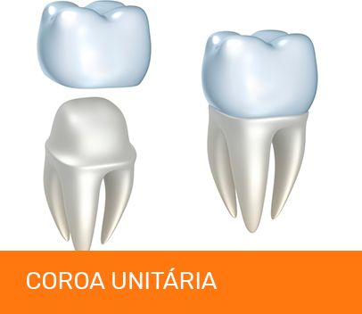 coroa unitaria
