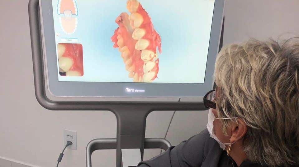escaneamento 3D com itero