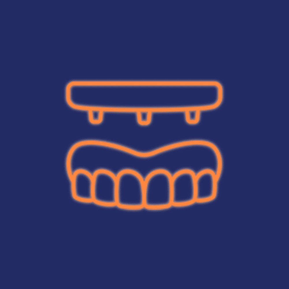 O principal benefício da carga imediata é ter dentes no mesmo dia com rapidez, já que o procedimento é realizado em uma única consulta, reduzindo o tratamento em um curto prazo. 