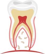 img-dente-1